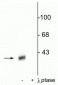 Anti-DARPP-32 (Thr34) Antibody