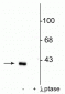 Anti-DARPP-32 (Thr75) Antibody