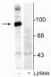 Anti-Dynamin (Ser774) Antibody