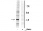 Anti-EphrinB (Tyr298) Antibody