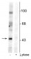 Anti-EphrinB (Tyr331) Antibody