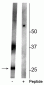 Anti-Aquaporin 2 (Ser261) Antibody