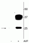 Anti-Aquaporin 2 (Ser269) Antibody