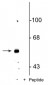 Anti-GABAA Receptor, ß3 (Ser408/409) Antibody