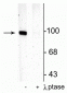 Anti-GluR1-Subunit (Ser831) Antibody