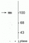 Anti-GluR1-Subunit (Ser845) Antibody