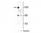 Anti-GluR2-subunit (Ser880) Antibody