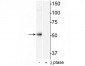 Anti-HDAC2 (Ser394) Antibody