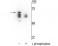 Anti-Hsp70 (Ser153) Antibody