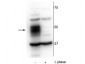 Anti-MEF2C (Ser222) Antibody