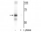 Anti-NF-kB p65 (Ser316) Antibody