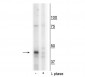 Anti-CK1Mt (Tyr153) Antibody