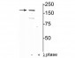 Anti-NMDA NR2A Subunit (Tyr1325) Antibody