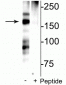 Anti-NMDA NR2B Subunit (Ser1166) Antibody