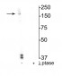 Anti-NMDA NR2B Subunit (Ser1166) Antibody