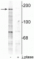 Anti-NMDA NR2B Subunit (Tyr1252) Antibody