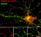 Anti-NMDA NR2B Subunit (Tyr1252) Antibody