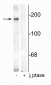 Anti-NMDA NR2B Subunit (Tyr1336) Antibody