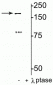 Anti-NMDA NR2B Subunit (Tyr1472) Antibody