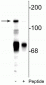 Anti-NMDA NR2C Subunit (Ser1244) Antibody