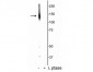 Anti-Potassium Chloride Cotransporter (KCC2) (Thr1007) Antibody