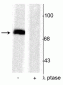 Anti-Synapsin I (Ser603) Antibody