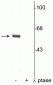 Anti-Synaptotagmin (Thr202) Antibody