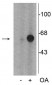 Anti-Tyrosine Hydroxylase (Ser31) Antibody