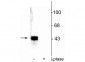 Anti-ERK/MAPK (Thr202/Tyr204) Antibody