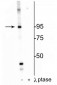 Anti-Insulin Receptor (Thr1160) Antibody