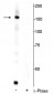 Anti-FANCI (Ser556) Antibody