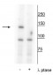 Anti-FANCI (Ser559) Antibody