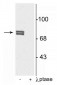 Anti-5-Lipoxygenase (Ser523) Antibody