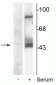 Anti-MEK1/2 (Ser218,222) Antibody