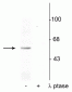 Anti-p53 (Ser392) Antibody