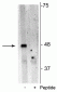 Anti-p62 (Ser28) Antibody