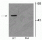 Anti-Parkin (Ser378) Antibody