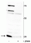 Anti-Troponin I (cardiac) Ser150 Antibody