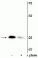 Anti-Troponin I (cardiac) Ser43 Antibody