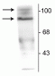 Anti-Progesterone Receptor (Ser190) Antibody