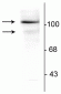 Anti-Progesterone Receptor (Ser294) Antibody
