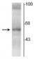 Anti-Thyroid Hormone Receptor, α2-Isotype Antibody