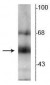 Anti-Thyroid Hormone Receptor, ß-Isotype Antibody