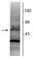 Anti-Retinoic Acid Receptor, α-Isotype Antibody