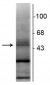 Anti-Retinoic Acid Receptor, ß-Isotype Antibody