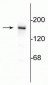 Anti-NMDA NR2B Subunit Antibody