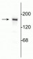 Anti-NMDA NR2B Subunit Antibody