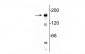 Anti-NMDA NR2B Subunit, N-terminus Antibody