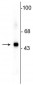 Anti-SAP49 Antibody