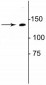 Anti-Collagen 1, alpha 1 telopeptide Antibody